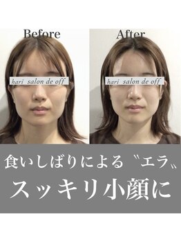 ハリサロンドオフ 心斎橋店(hari salon de off)/エラにアプローチ♪