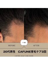 カフネスカルプケアルーム(CAFUNE SCALP CARE ROOM)/