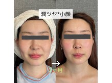 セレブリボーン 大阪ボーテの雰囲気（巻き戻しは早めに行う事で将来の【老化スピード】激変します。）