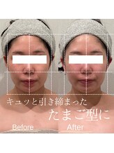 エステティックサロン ラ ベルタ(Esthetic Salon La Belta)/華奢みえコルギ