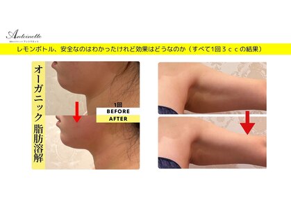 エステティック アントワネットの写真