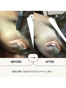 ミヌエット 新宿御苑(Minuet)/うなじシュガー×光脱毛