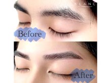 【メンズ眉大好評!】左右差などお悩み解消!WAX脱毛で生えにくく!