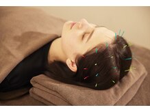 カドモリ 心斎橋(KADOMORI)/【美容鍼/大阪美容鍼/小顔矯正】