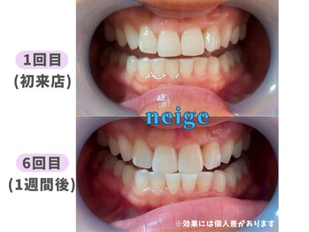 ネージュ(neige)/40代前半/女性/ お茶1日2杯