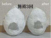 コルギサロン 伏見店(k_korugi.salon)/歯ぎしり改善にコルギ◎◎