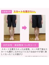 えのもと美容整体院/【美脚・O脚改善】