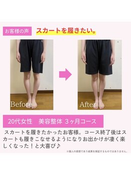 えのもと美容整体院/【美脚・O脚改善】