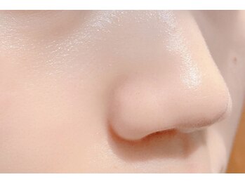 ララ オートクチュール(LALA HAUTOCOUTURE)の写真/【最新機器で毛穴の洗浄】小顔とのセットで夏の疲れも一緒にリセット！