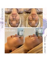 サロン ド ブラン アオヤマ(Salon de BLANC AOYAMA)/SENTEALESフェイシャル