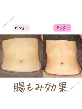 クリア リラクゼーションサロン(Clear)/サイズダウン♪美BODYに♪