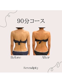 セレンディピティー(Serendipity)/姿勢・首肩凝り改善