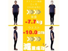 フィット(Fit)の雰囲気（見てほしいのは“数字”じゃなく、変わった“ライン”）