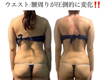 痩身革命 大宮店/リンパ血流を流し太りにくい体質