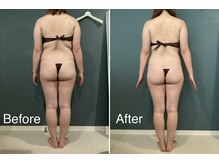 サンニロク(326)/４０代のお客さま/８回施術