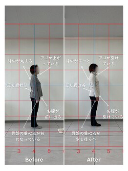 ハル 箕面(HALU)/4回目before&after姿勢改善