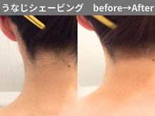 ももとゆでたまご/うなじビフォーアフター/新宿