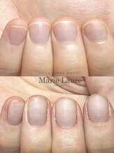 マリーロール 淀屋橋本店(Marie Laure)/自爪育成/深爪矯正/ネイルケア