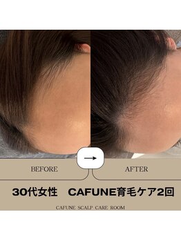 カフネスカルプケアルーム(CAFUNE SCALP CARE ROOM)/