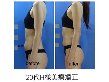 エステージ(estage)/