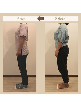 晴れ晴れ整体院/3回目！別人級の効果