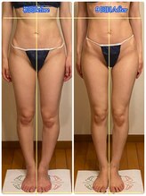 トータルボディセラピーハート(Heart)/細い！長い！本物の美脚が叶う！