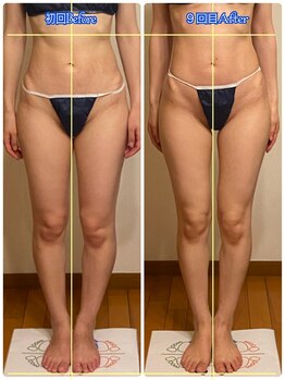 トータルボディセラピーハート(Heart)/細い！長い！本物の美脚が叶う！