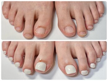 足の深爪も綺麗に