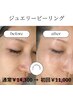ジュエリーピーリング６０分気になるシミ・つやつやなお肌を目指す方に！岐阜