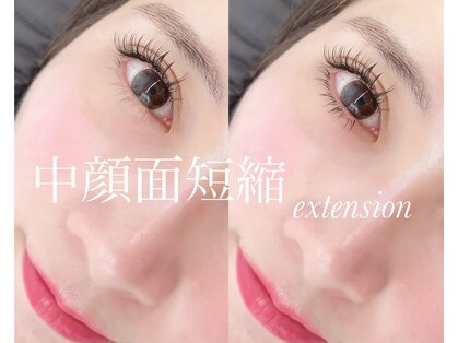 トレア(TREA)の写真