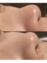 ソワレ(soiree)/肌改革