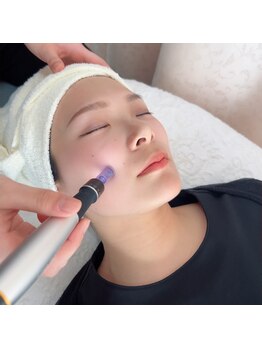 ハノハノ 八代店(HANO HANO)の写真/結果重視の方必見!アクアダーマ(美容液導入トリートメント)導入!ダウンタイムなしで安心♪