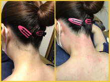 クラウン ジュエルズ(CROWN JEWELS)/【Wax脱毛】うなじ　サイド 5