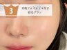 【お肌も綺麗に☆】美肌フェイシャルワックス付き眉毛プラン