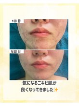 マルロ美容整体院 バイ サロンリーナ(MARLO美容整体院 by Salon Lena)/