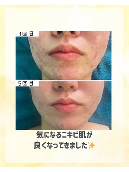 マルロ美容整体院 バイ サロンリーナ(MARLO美容整体院 by Salon Lena)/