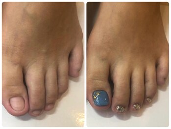 足の深爪も初回から綺麗に