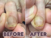 ポドロ ウィズ ニコルル 大阪天満店(PoDoLo with Nicolulu)/【二枚爪】フットケア大阪・梅田