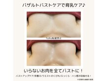 タイカ(Taika)の雰囲気（左右差/横流れ/バストアップ/下垂/産後◎理想なバストが目指せる）
