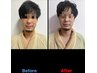 【男性特別限定】デキる男の、新常識！肌質改善メタジェクト