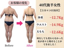 ベルホワイト(Belle White)/【40代後半/3ヶ月の変化】