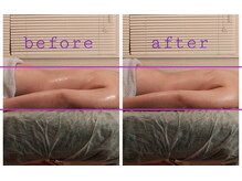 体の巡りが良くなり背中まわりのむくみが自然と軽くなります。