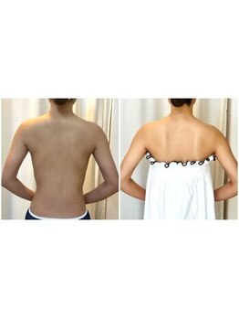 ティアエ(T-ae)/【ブライダルエステ】