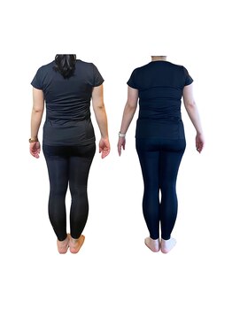 リニューアル(renewal)/骨盤のゆがみ、O脚改善