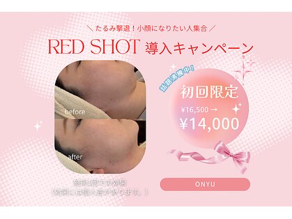 オニュ(onyu)の写真