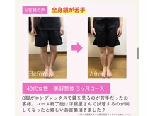 えのもと美容整体院/【美脚・O脚改善】