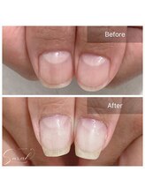 サラ(Sarah.)/深爪ケアメニュー