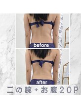 ハロ 南青山(HALO)/脂肪分解スタンプ20push