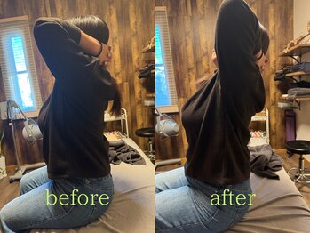 アポヨ鍼灸院(APOYO鍼灸院)/本格整体　before/after