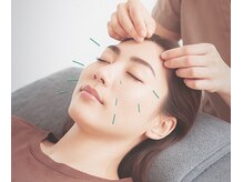 アスリー(ATHREE)の雰囲気（待望の鍼灸スタート！オーダーメイド全身鍼灸、美容鍼）